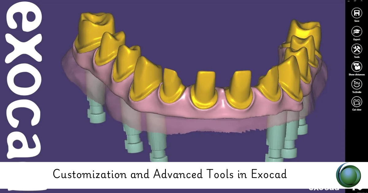 Advanced Tools in Exocad