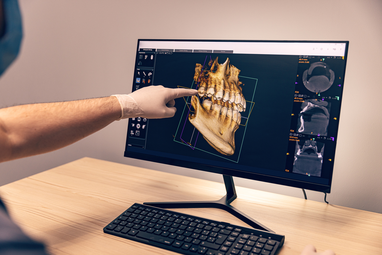 Digital Dentistry: Basics of Exocad Workflow