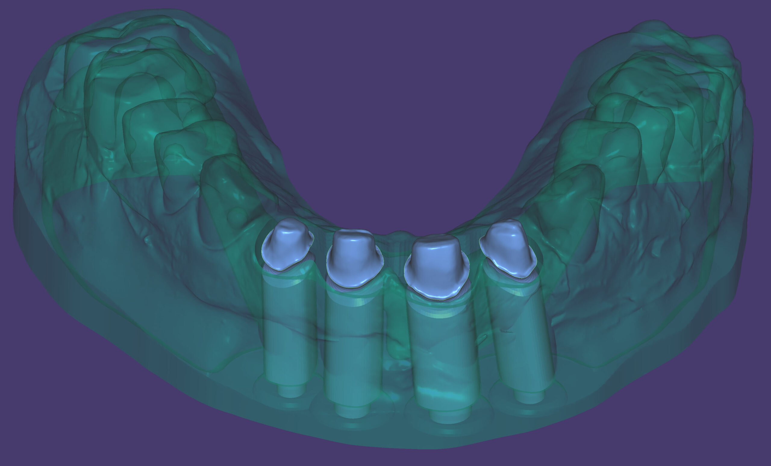 Case Management in Exocad