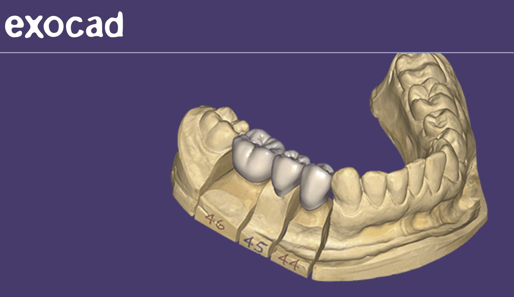 Exocad Dental CAD