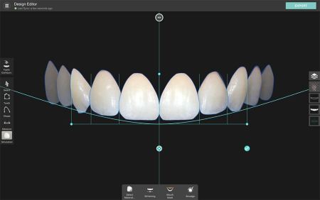 Smile Design and Aesthetic Planning